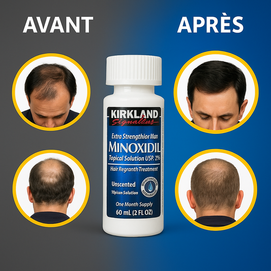 Minoxidil Kirkland