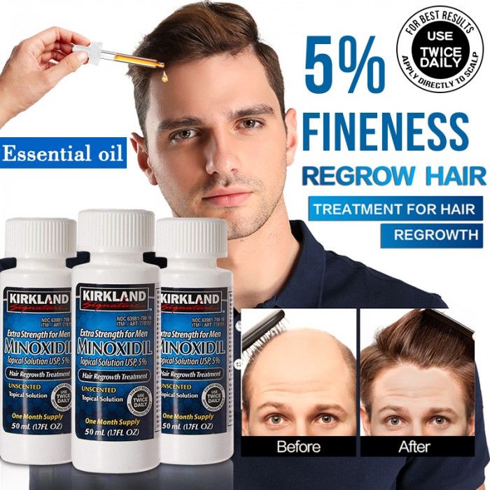 Minoxidil Kirkland