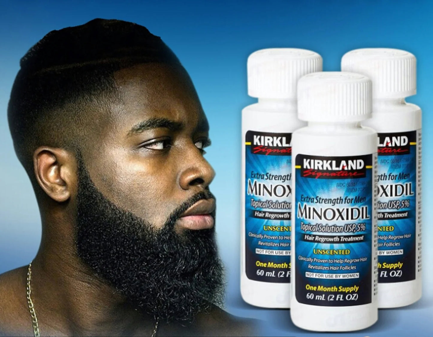 Minoxidil Kirkland